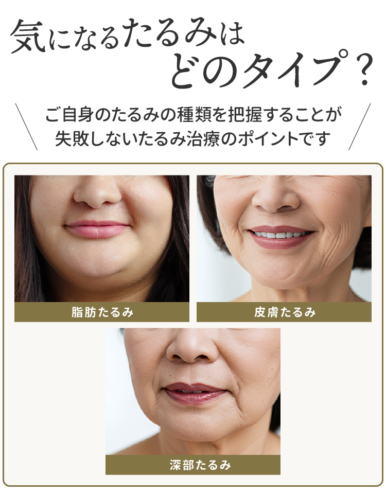 気になるたるみはどのタイプ？