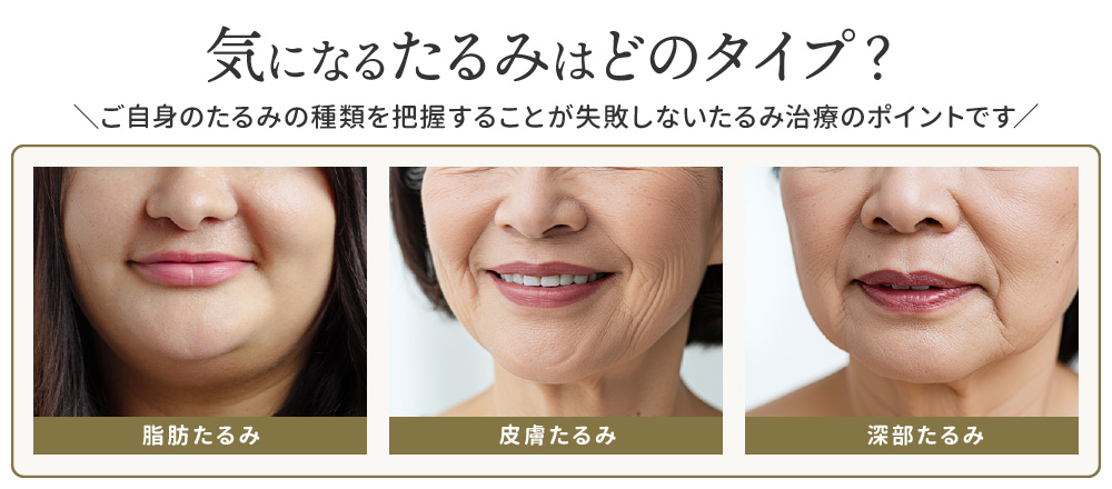 気になるたるみはどのタイプ?